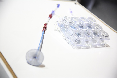 先天性心脏病缺损封堵装置